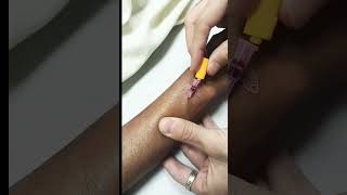 How to inserting cannula in veincannulation ivcannulation [upl. by Hallerson]