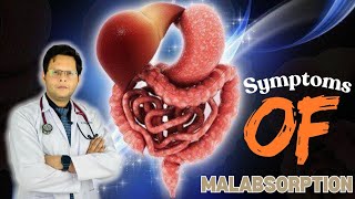 Pediatric Malabsorption Syndrome  causes symptoms treatment Factors  DrAmmar Asif [upl. by Thanos]