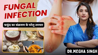 Do Home Remedies Work for Fungal Infections  Dr Megha  Coconut Oil for Fungal Infections [upl. by Bibby]