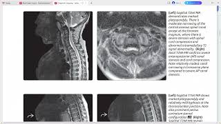 SPINE IMAGING DIAGNOSTIC IMAGING SERIES [upl. by Osithe]