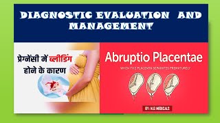 Abruptio Placenta  Diagnostic Evaluation Treatment Part 2  Full Explain in Hindi  N G Medical [upl. by Robbin]