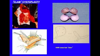 Urodynamic studies in children Made Simple [upl. by Trescott776]