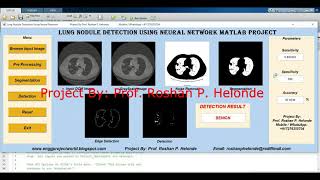 Lung Nodule Detection On Dicom Image Using Neural Network  With Source Code  Matlab Project Code [upl. by Hadlee]