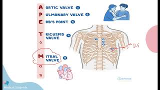 Lec2 Mitral stenosis  internal Medicine [upl. by Alleciram208]