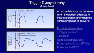 Pathologic Complications Mechanical Ventilation  Lecture 11 [upl. by Slinkman]