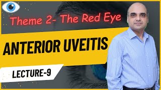 Anterior Uveitis Lecture 9 [upl. by Enihpesoj]