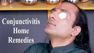 Conjunctivitis Treatment  How To Cure Conjunctivitis  Home Remedies For Conjunctivitis [upl. by Kesley]