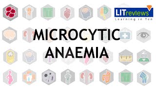 Microcytic Anaemia [upl. by Tteltrab]