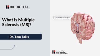 What is Multiple Sclerosis MS  Dr Tom Talks [upl. by Gunilla35]