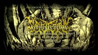 SYPHILECTOMY  Abnormality Through Purulent Sputum Official Video Stream [upl. by Aloap475]