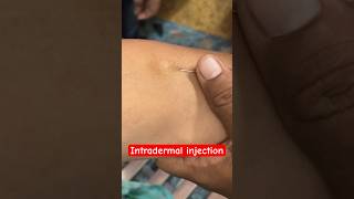 Intradermal injection  hospital ivcannulation trending mbbs subscribe SMpharmacy [upl. by Siwel]