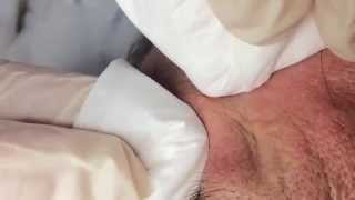 How To Remove a Whitehead Soft Sebum [upl. by Novikoff596]