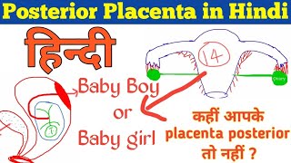 Posterior placenta in hindi  posterior placenta Kya hota hai [upl. by Tayler770]