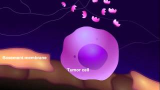 Introduction to Cancer Biology Part 3 Tissue Invasion and Metastasis [upl. by Constantia]