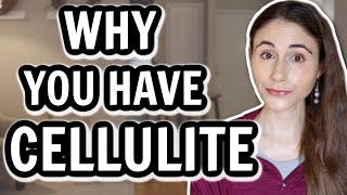 WHY YOU HAVE CELLULITE amp HOW TO GET RID OF IT  Dermatologist DrDrayzday [upl. by Vassell998]