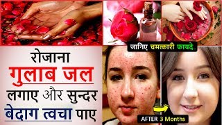 गुलाब जल के फायदे 🌹 For Face Wrinkles Eyes Skin Hair Ear  Rose Water Health Benefits in Hindi [upl. by Sharron]