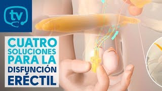 4 soluciones o tratamientos para la disfunción eréctil [upl. by Yann869]