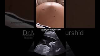 Ultrasound scan Report [upl. by Heady326]