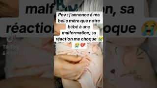 ✨ Pov Quand Tu Annonce A Ma Belle Mere Que Notre Bebe A Une Malformation Sa Reaction Me Choque😱💔 [upl. by Dowling]