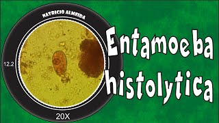 Entamoeba histolyticadispar [upl. by Wiltz]