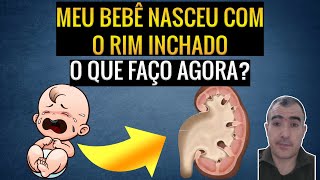 HIDRONEFROSE PÓS NATAL meu bebê nasceu com o rim inchado O que faço agora  Parte 2 [upl. by Etnod]