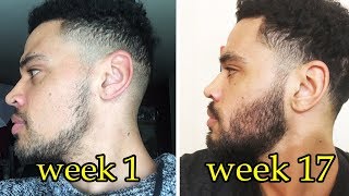 My Minoxidil Beard Journey  Week 17  Pre Minox Photos [upl. by Aihtnyc571]