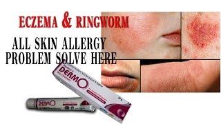 eczema Skin allergy homeopathy madicine Radients DERMO skin ointment ringworm best madicine [upl. by Calia]