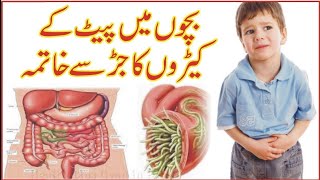 stomach worm pait main keero ka ilaj  chamoonay  pinworm  پیٹ میں کیڑے ختم کرنے کا آسان علاج [upl. by Cower]