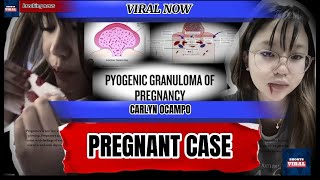 Carlyn ocampo pregnant case [upl. by Lombardy769]