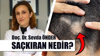 Saçkıran hastalığı nedir  Saçkıran ve sakal kıran nasıl tedavi edilir  Doç Dr Sevda ÖNDER [upl. by Welcher]