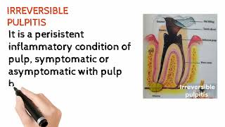 Irreversible PulpitisEndodonticspulpalinflammation [upl. by Carr]