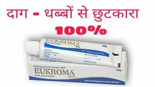 How To Remove Melasma  Hyperpigmentation  Eukroma cream uses sideeffects price review in hind [upl. by Esiled384]