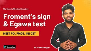 Froments sign and Egawa test  FMGE NEET PG INICET [upl. by Ynohtnanhoj549]