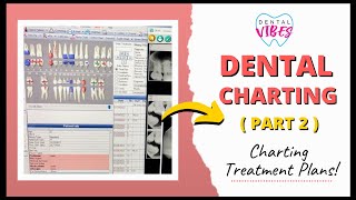 DENTAL CHARTING TX PLANS  PART 2  Charting for Dental Assistants [upl. by Arjun]