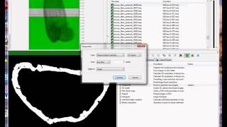 Cortical bone 1 periosteal and endosteal parameters [upl. by Nattirb]