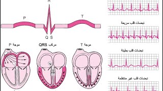 ECG of MI and Stenocardia [upl. by Adnah703]