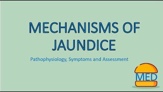 JAUNDICE MADE EASY  Mechanism Pathophysiology and Assessment [upl. by Dj]