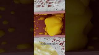 How to Remove Ear Wax Blockage the Right Way shorts facts  creativelearning3d [upl. by Oirevas]