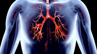 How to Remove Calcium Deposits From Arteries  Clogged Arteries Home Remedies [upl. by Gent660]