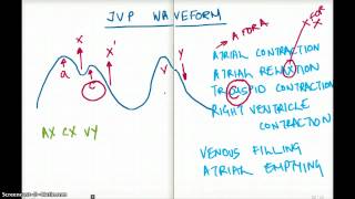 EASY WAYS TO REMEMBER JVP WAVEFORM [upl. by Akirdnas]