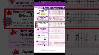 ECG EKG Rhythms to Know Sinus Rhythms Sinus Tachycardia Heart blocks etc [upl. by Onaled]