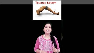 TT ஊசி போடுவது ஏன்  tetanusvaccine tetanus scienceinsights shorts tamilshorts [upl. by Rebme]