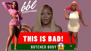 Miss RFabulous BBL  Botched body shock  Surgery gone wrong [upl. by Bocock]