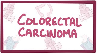 Colorectal carcinoma  causes symptoms diagnosis treatment pathology [upl. by Mixam]