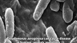 Pseudomonas aeruginosa Infections [upl. by Aerdnaed]