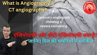 क्या कराये Ct Coronary Angiography या Conventional catheter based angiography [upl. by Scarrow]