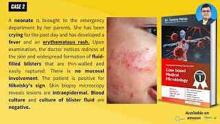 Case based Medical Microbiology Tutorials Case 2 Neonate with erythematous rash and blisters [upl. by Jerad]