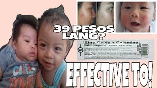 OINTMENT FOR BABY RASHES AND ACNE  CALMOSEPTINE REVIEW [upl. by Akinhoj35]