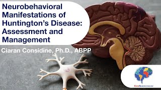 Neurobehavioral Manifestations of Huntington’s Disease Assessment and Management [upl. by Ybbil]