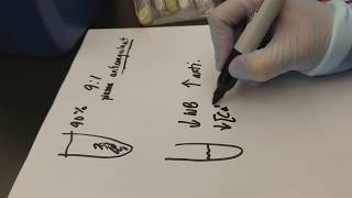 Coagulation aPTT Test Part 1 [upl. by Anirrok]